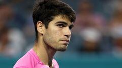 The former American player slammed the two-time major champion for not improving his serve.