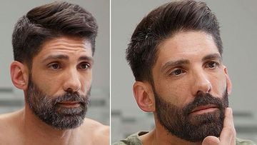 Barba teñida, antes y después de aplicar el tinte.