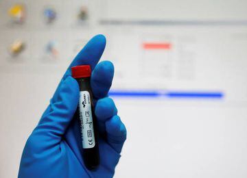 A technician holds a test tube with a blood sample at the Russian anti-doping laboratory in Moscow.