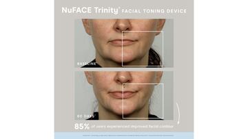 Antes y después de usar tonificador facial