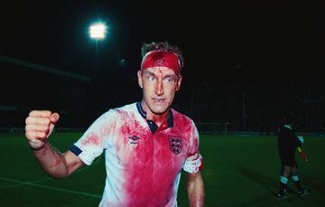 Terry Butcher sangrando en un duelo de la selección inglesa frente a Suecia en el Mundial de Italia 1990.