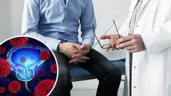 Primeros síntomas del cáncer de próstata