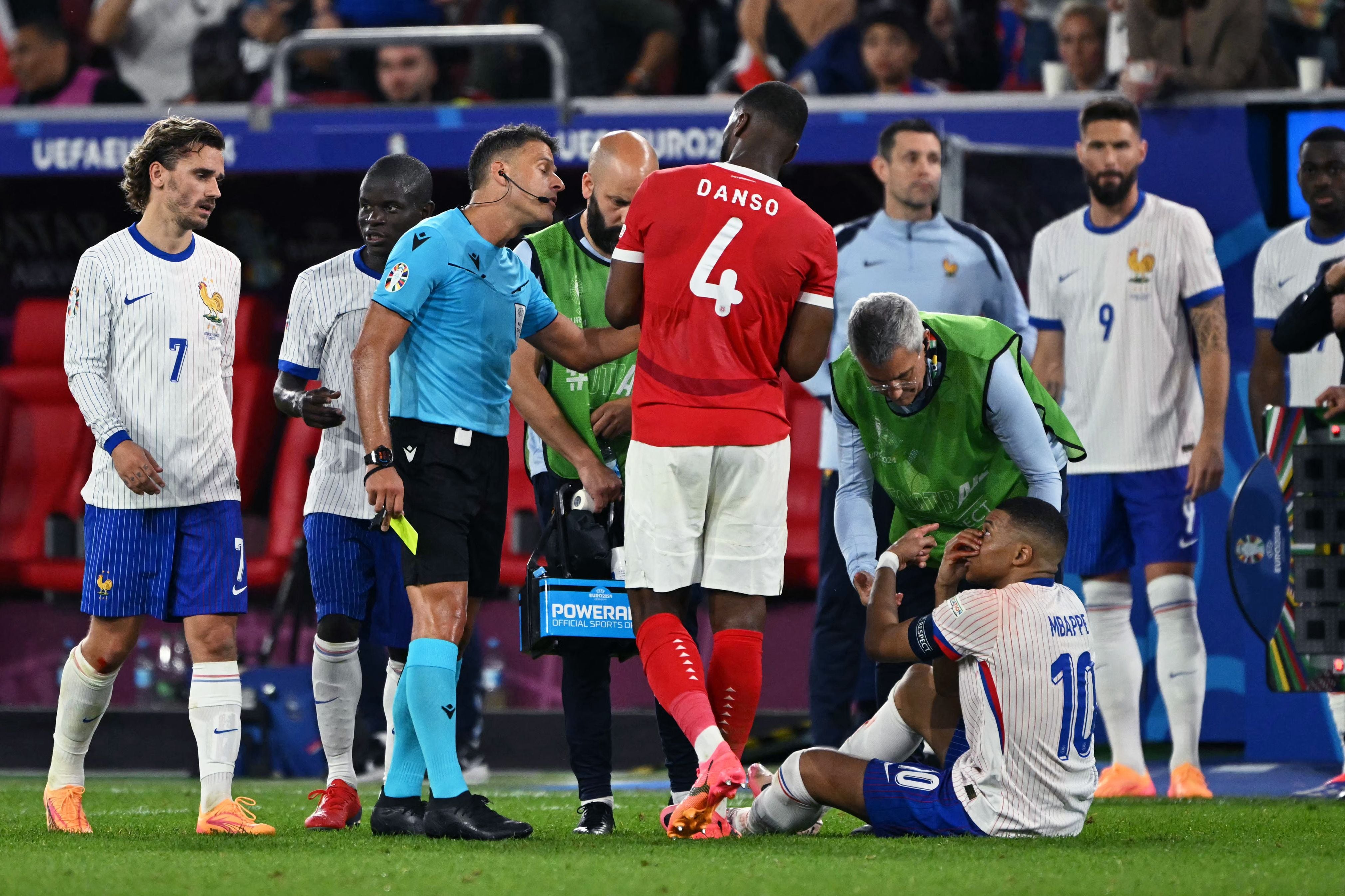 Inglaterra clama contra Mbappé por su gesto tras romperse la nariz
