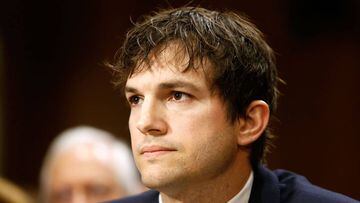 Ashton Kutcher, a punto de perder la vista y el oído por una rara enfermedad