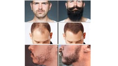 Consigue una barba más larga y sana con este kit estrella de Amazon