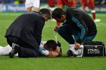 Carvajal is also injured and has to be substituted.