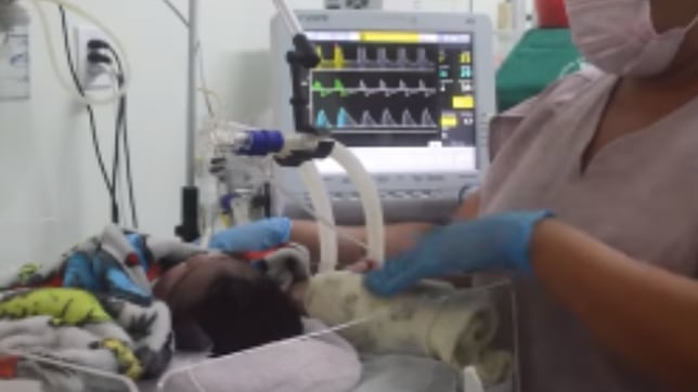 A giant two-foot-tall baby weighing 16 pounds born in Brazil