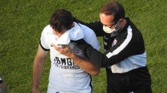 Mauro Boselli sufre fractura en la cara tras choque en la cancha