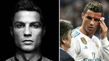 Cristiano Ronaldo: las redes muestran la cicatriz que le ha quedado en la cara