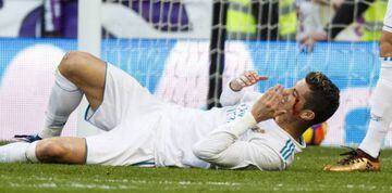 Ronaldo just after being injured