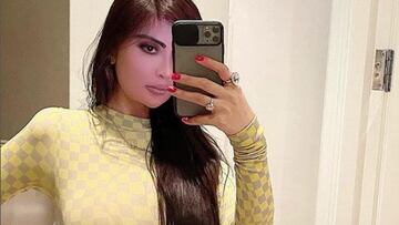 Una modelo brasileña se gasta medio millón de euros para ser como Kim Kardashian: “Un gran error”
