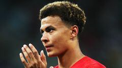 England's Southgate optimistic over Alli recovery for Belgium