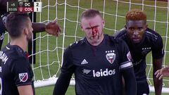 Bienvenido a la MLS: Rooney termina el partido con nariz rota