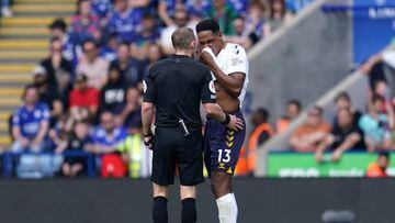 Yerry Mina salió lesionado en el partido entre Leicester City y Everton por la fecha 36 de la Premier League.