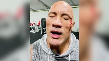The Rock se hace una herida entrenando y su reacción es viral