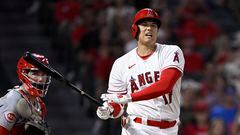 The Los Angeles Angels star has suffered an injury that will see him sit on the sidelines for a long time.