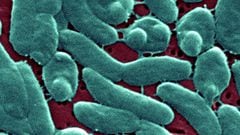 Rare, flesh-eating bacteria have been linked to the deaths of several people in the US. What is Vibrio vulnificus and how does it affect the human body?
