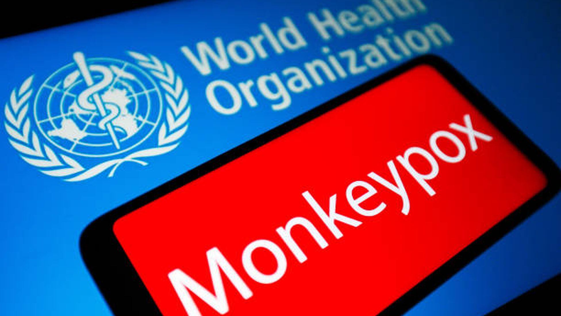 Monkeypox latest news summary | 21 May 2022 - AS USA