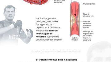 Gráfico: el tratamiento médico al que ha sido sometido Casillas