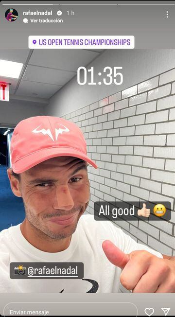 El tenista español Rafa Nadal posa tras la herida que se produjo en la nariz con un raquetazo fortuito durante su partido ante Fabio Fognini en el US Open.