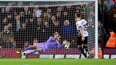 Liverpool goalkeeper Caoimhin Kelleher saves a penalty from Derby County's Craig Forsyth during the penalty shoot out of the Carabao Cup third round match at Anfield, London. Picture date: Wednesday November 9, 2022. (Photo by Nigel French/PA Images via Getty Images)