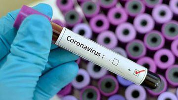 Coronavirus: ¿por qué es más grave en los hombres que en mujeres?