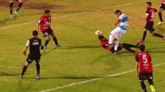 La grave lesión que sufrió un jugador de Antofagasta