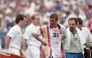 Luis Enrique of Spain, who suffered a bloody broken nose in the 1994 World Cup when he was elbowed in the face by Italy's Mauro Tassotti.