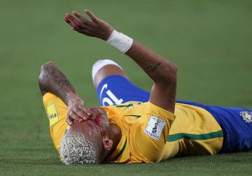 Neymar requests assistance after being elbowed in the face by Bolivia's Duk.