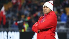 Tonga coach Kefu "safe" after surgery following armed robbery attack