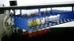 Imagen de unas muestras de orina en el Laboratorio Nacional Antidopaje de Francia en Chatenay-Malabry, a las afueras de Par&iacute;s.
