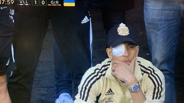 El Yamiq, jugador del Real Valladolid, en una imagen de televisi車n, con el ojo derecho tapado.