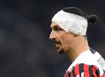 El chileno Gary Medel y el sueco Zlatan Ibrahimovic protagonizaron un fuerte choque durante el partido entre el AC Milan y el Bolonia. Los dos jugadores quedaron tendidos en el césped, sangrando. Necesitaron de asistencia médica para poder incorporarse.
