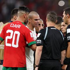 Pepe se rompe el brazo y estalla: “Es inadmisible un árbitro argentino en nuestro partido...”
