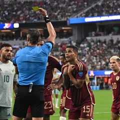 El error de México que provocó el gol de Venezuela
