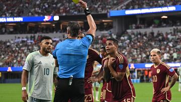 Venezuela's defender #15 Miguel Navarro and Mexico's forward #10 Alexis Vega receive yellow cards during the Conmebol 2024 Copa America tournament group B football match between Venezuela and Mexico at SoFi Stadium in Inglewood, California on June 26, 2024. (Photo by Patrick T. Fallon / AFP)
