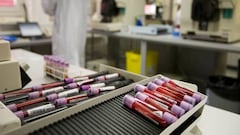 Muestras de sangre en el laboratorio de an&aacute;lisis antidopaje de Lausana (Suiza).
