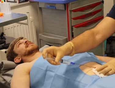 La recuperacin express de Arnold Allen: reconstruccin de abdomen para volver a la UFC