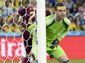 Igor Akinfeev con el puntero de un laser en la frente.