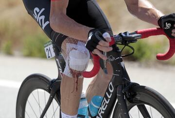 La rodilla de Chris Froome. 