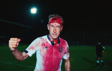 Terry Butcher sangrando en un duelo de la selección inglesa frente a Suecia en el Mundial de Italia 1990.