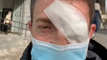 Imagen de Pablo Motos tras salir de una intervención quirúrgica.