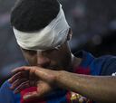 Rafinha sufre una fractura nasal y estará en la vuelta de la Copa