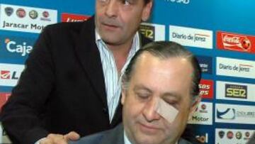 <b>DIMITE.</b> Joaquín Bilbao, hasta hoy presidente del Xerez, anunció su dimisión del cargo tras la reunión del consejo de administración, por su presunta implicación en el tiroteo contra un bar de Jerez de la Frontera.