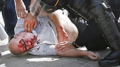 English hooligan enters into cardiac arrest as violence flares in Marseille