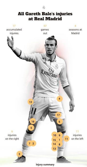 All Bale's injuries (click to expand)