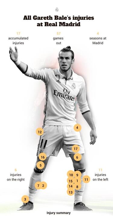 Gareth Bale to miss Champions League derby: out for a month