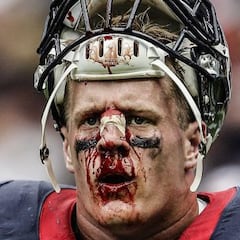 Superman J.J. Watt: jugó con cinco músculos rotos