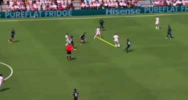 Xabi saca el bisturí