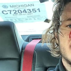 El youtuber 'WhistlinDiesel' se dispara en la cabeza